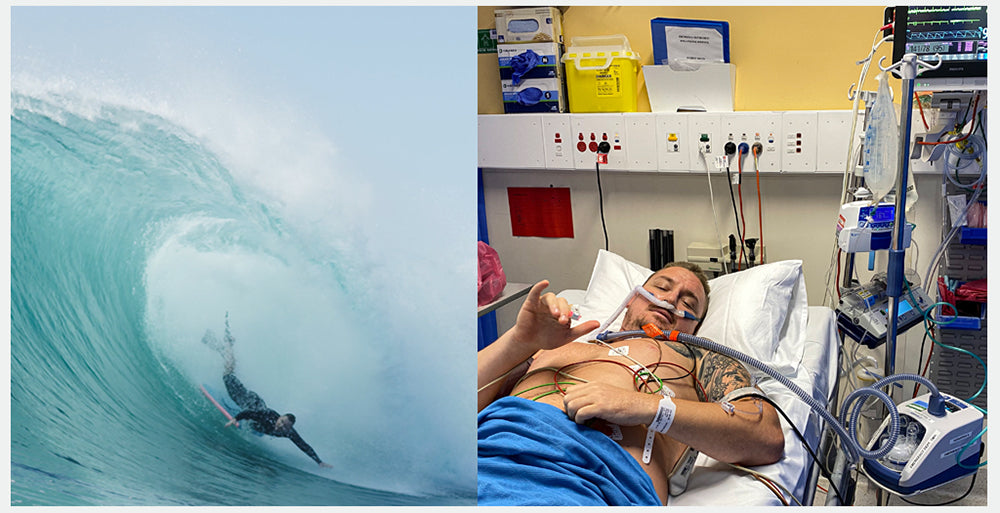 Surfing Wipeout - 4 Broken Ribs & Perforated Lung!